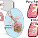 Illustration for article titled Apakah Penyakit Paru Paru Basah Dapat Menyebabkan Kematian